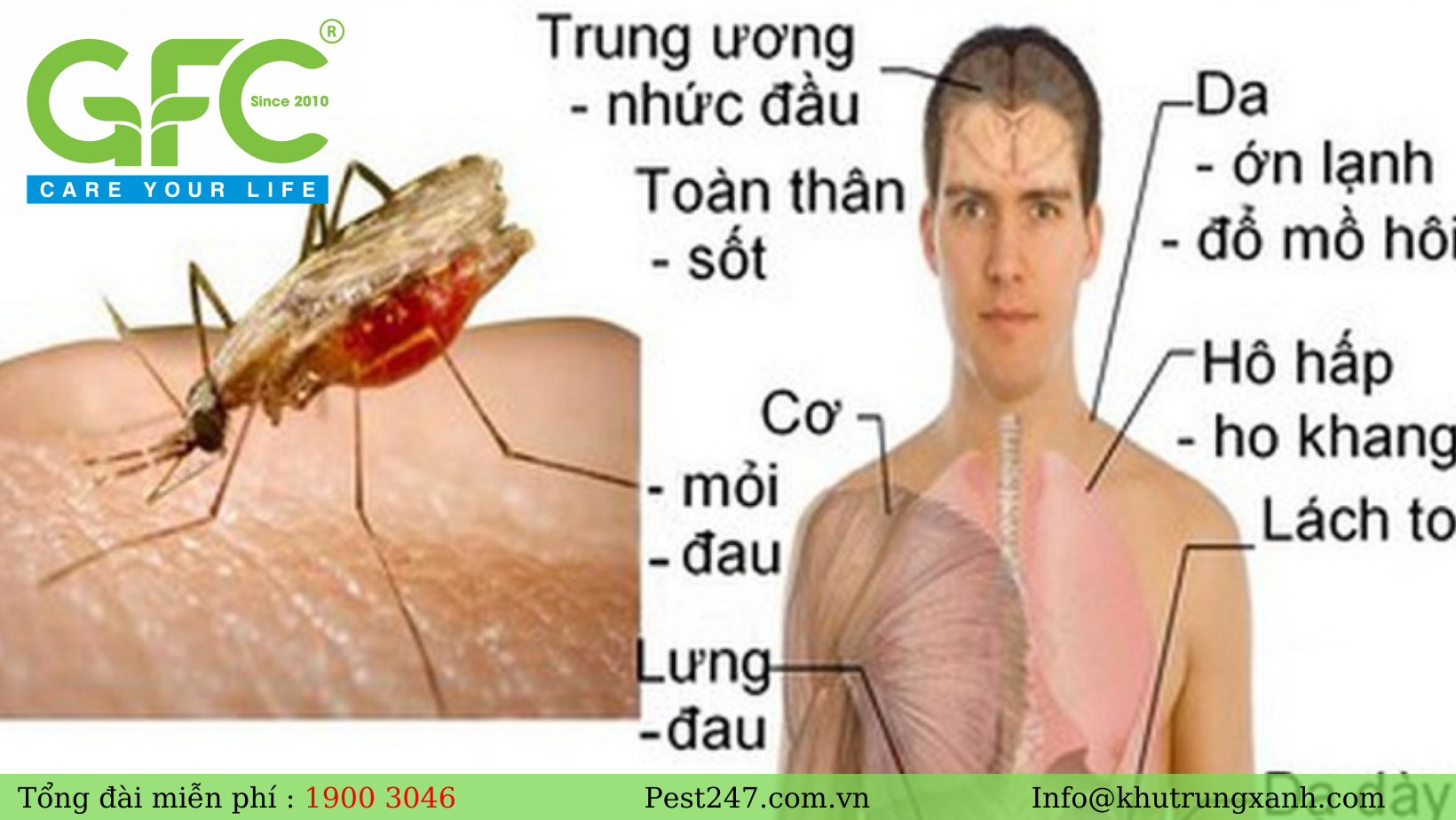 Triệu chứng của bệnh sốt rét do muỗi